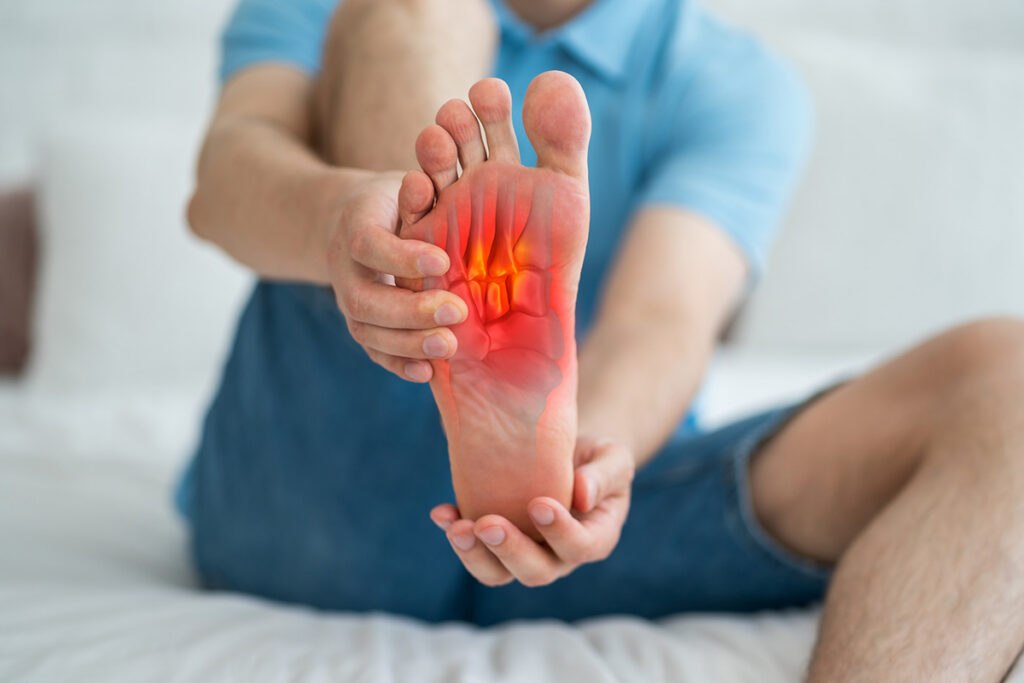Pes Planus Flat Feet Highlighted on Veteran's foot